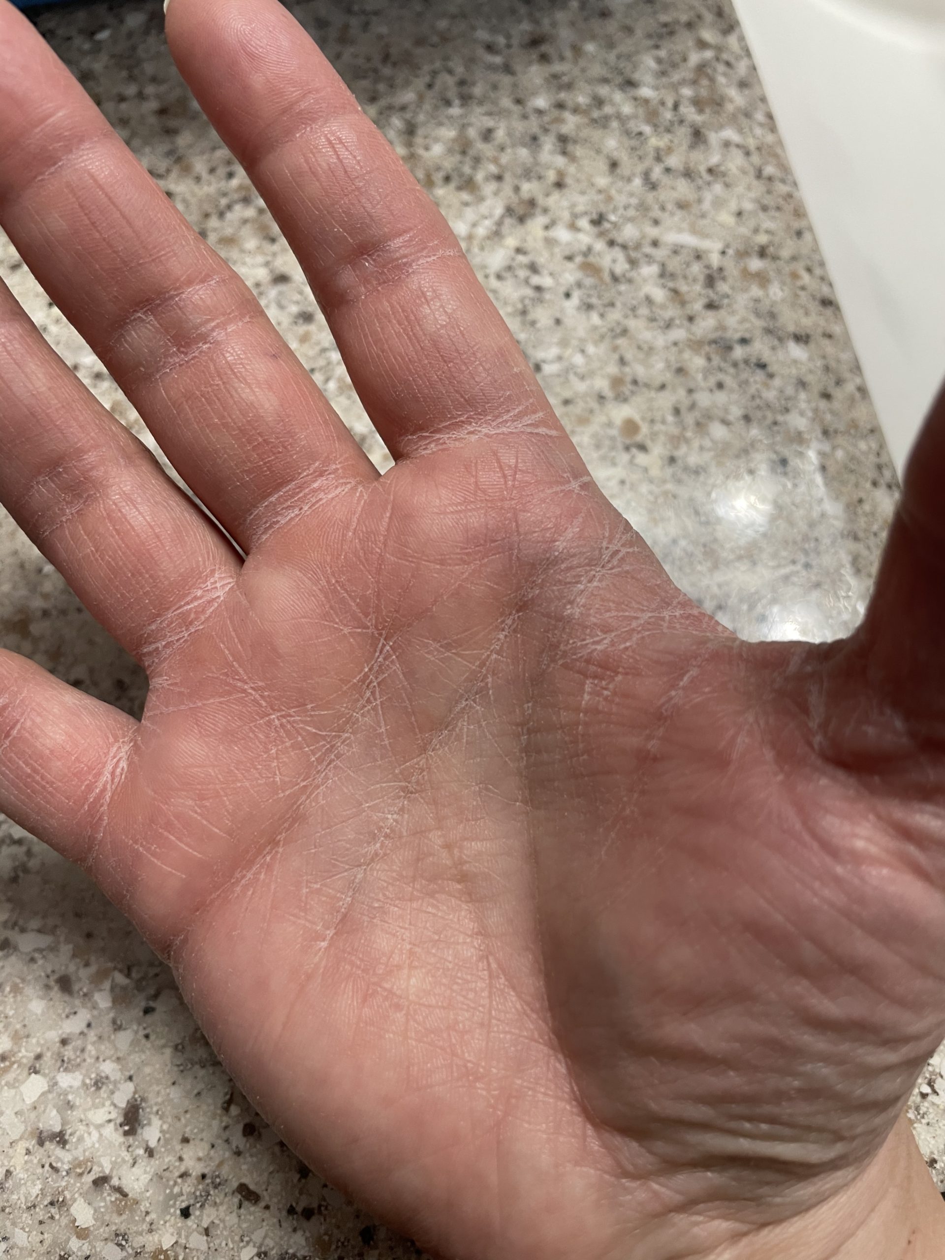 Dry hand